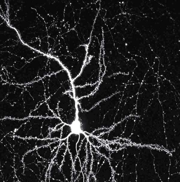 Image of a Neuron