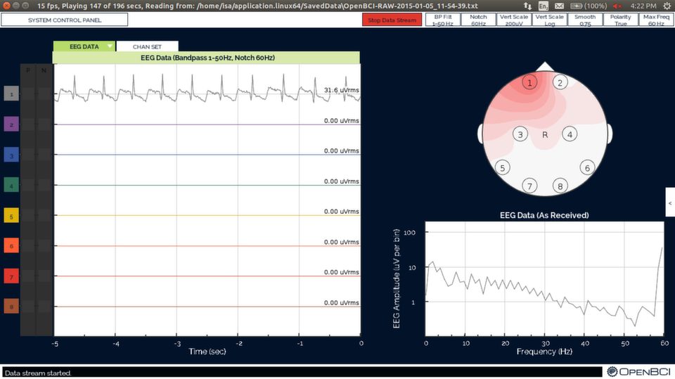 OpenBCI EKG Test Screenshot Fast