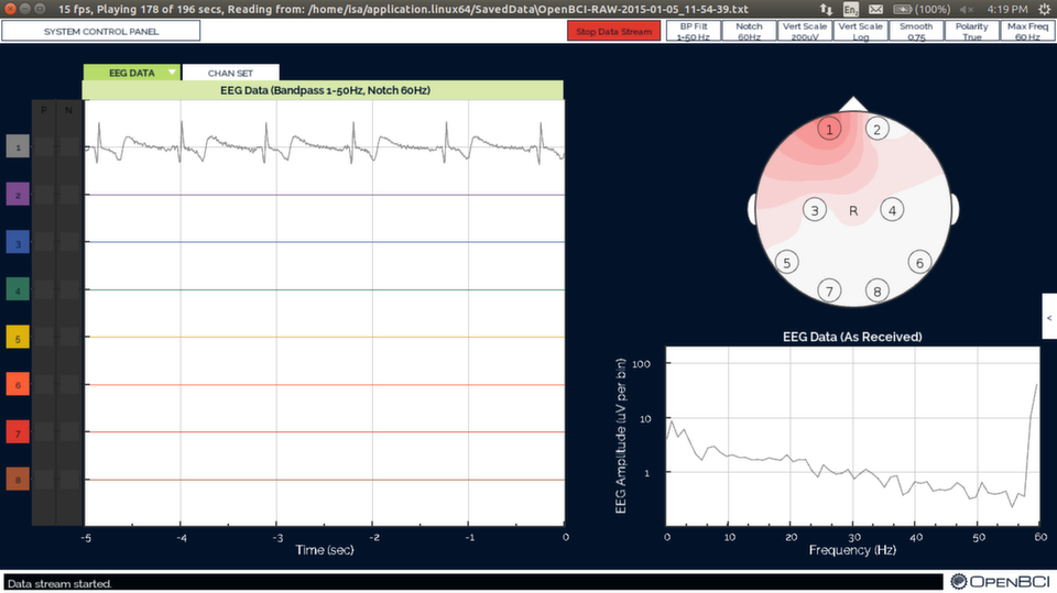 OpenBCI EKG Test Screenshot
